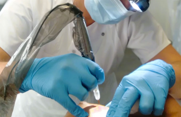 Dermopigmentation proche de Lille